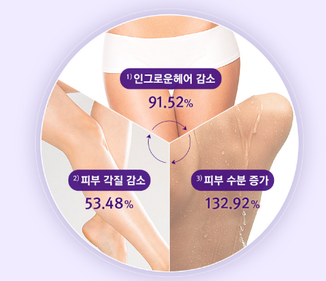 효과! 인그로운헤어 확실히 줄었어요 
