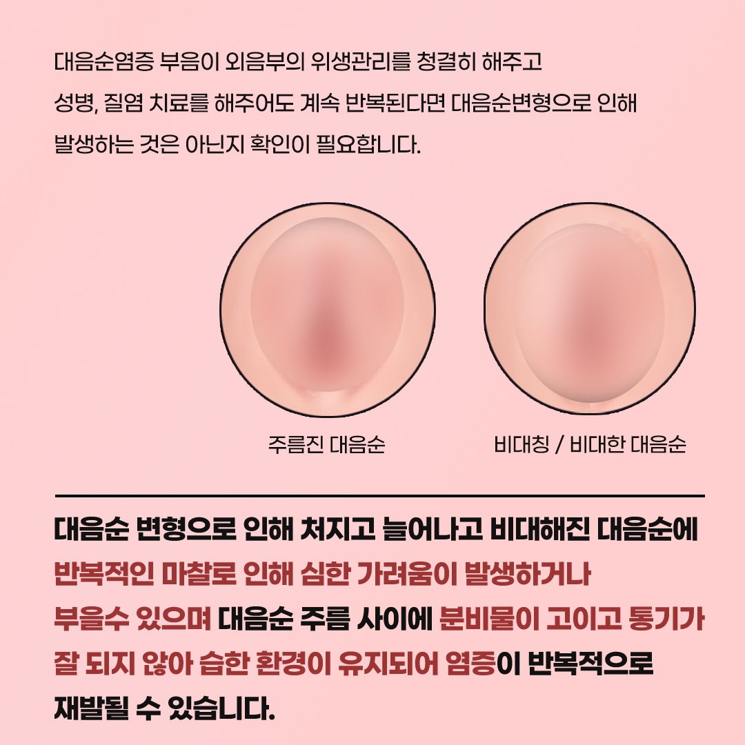 논현산부인과
외음부염 간지러움
외음부염 간지러움 원인 - 대음순 변형