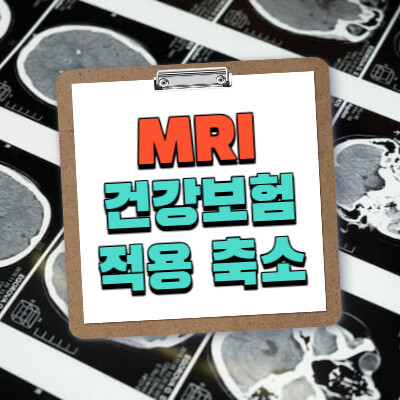 MRI-건강보험-적용-축소