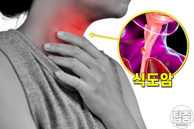 초당 옥수수 보관법,옥수수 검은색 검은점,팁줌