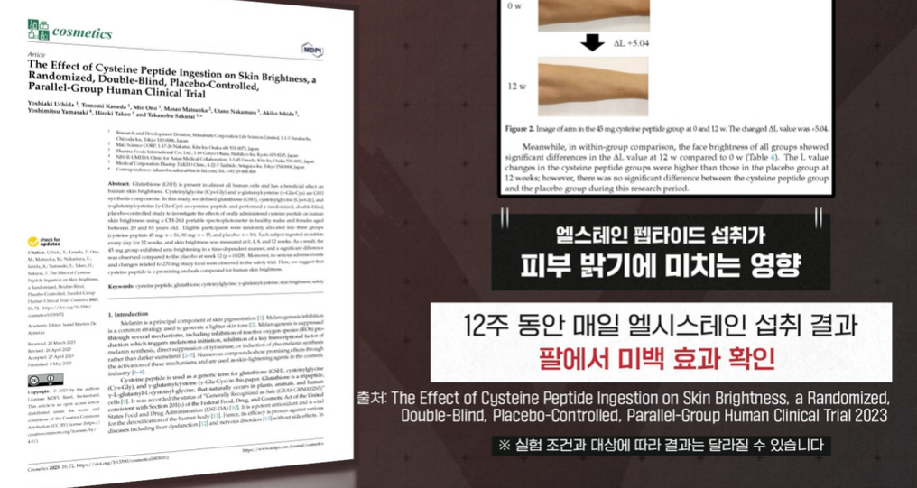 엘시스테인 효능