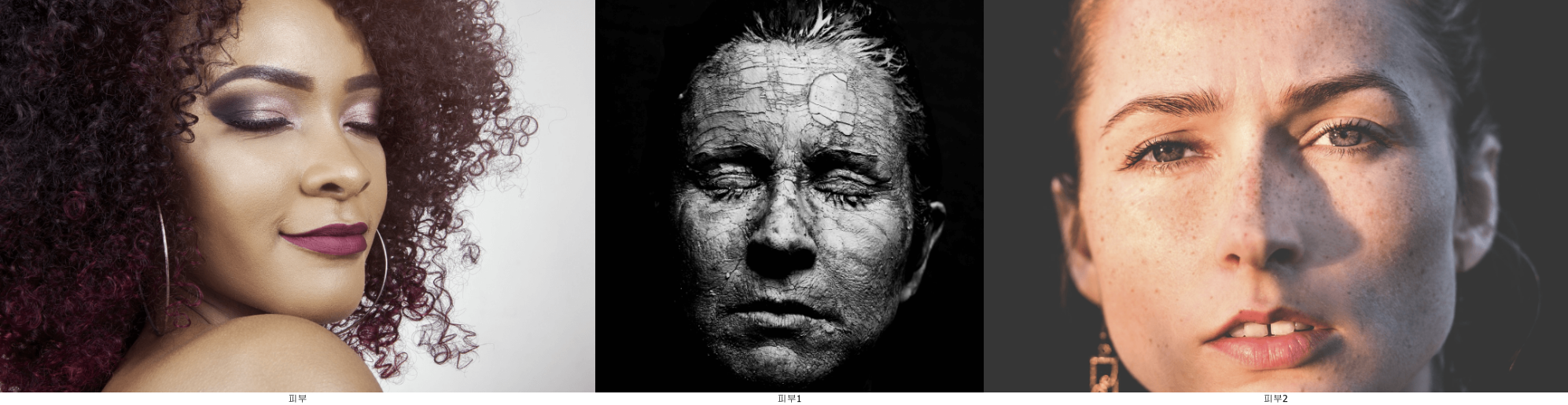 피부 탄력 개선, 주름 감소