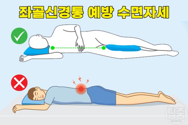 좌골신경통 예방 수면자세