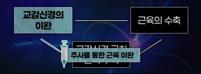 스탭피 주사