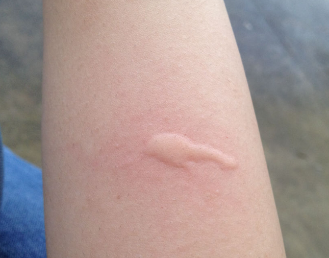 모기기피제 종류 및 효과 정리, 내가 잘 쓰는 벌레퇴치제는 전우 아쿠아가드 액