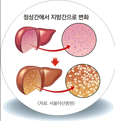 간(7)