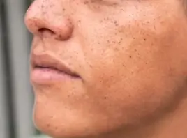 고혼진 기미크림 내돈내산