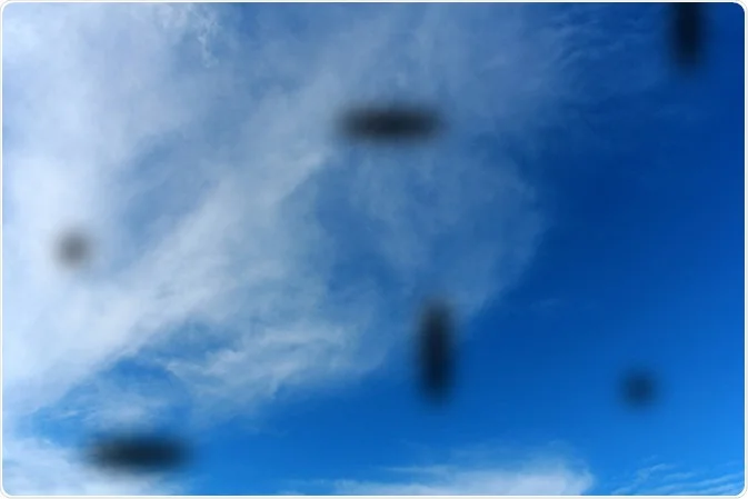 비문증-플로터 원인과 증상 및 관리