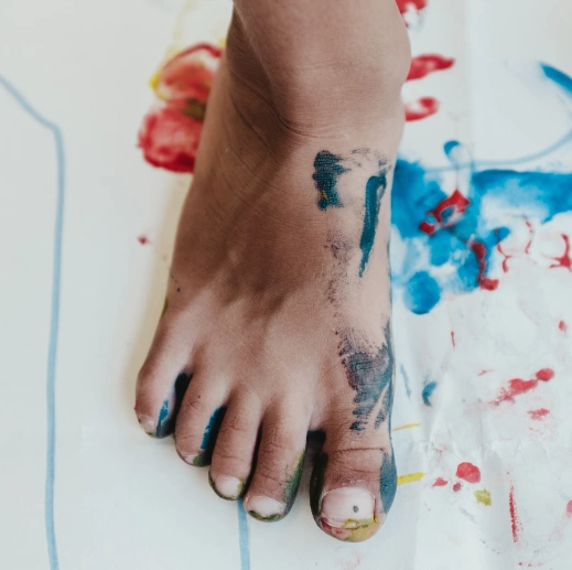 발가락 봉와직염 증상