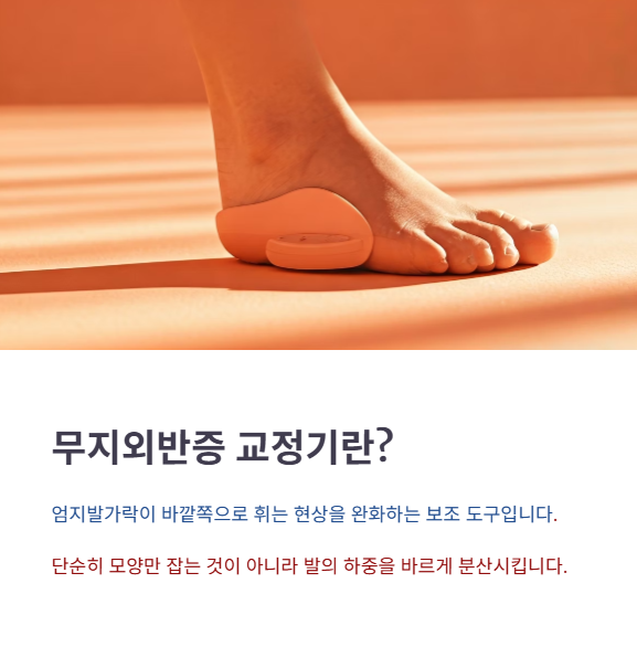 무지외반증 교정기란 무엇일까