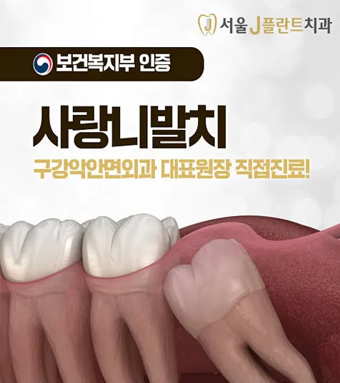 서울J플란트치과의원