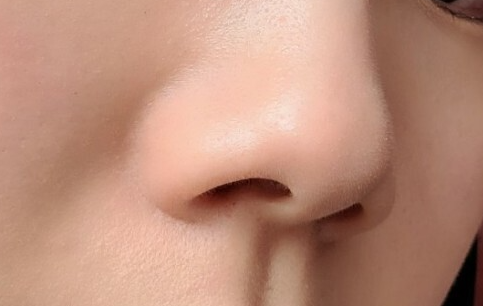 코조각주사 후기