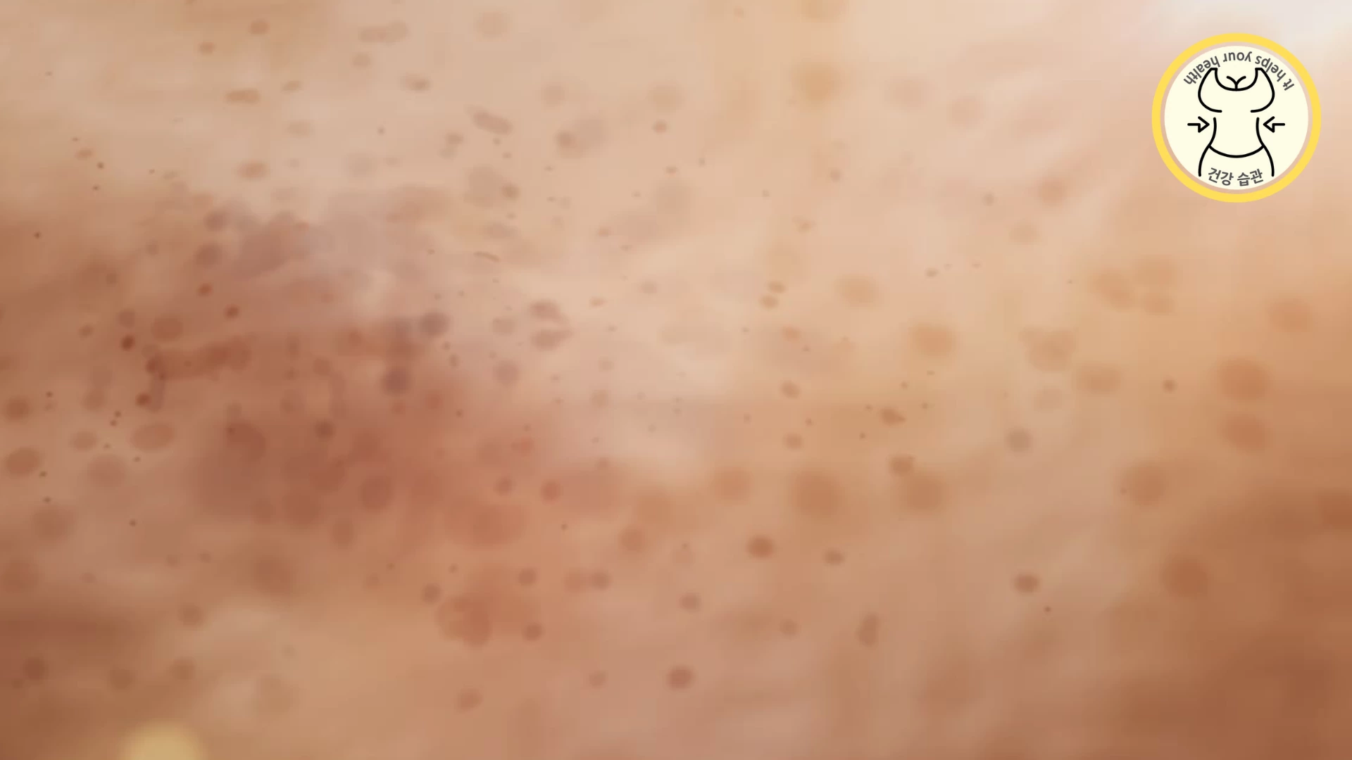 피부 노화 기미