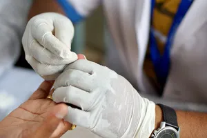 손가락-마디-통증