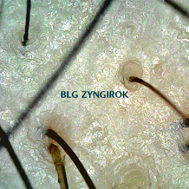 피나모아 복용 1주차 두피사진. 모낭 하나당 한두개의 모발이 위치해 있지만&amp;#44; 많이 얇아진 상태이다.