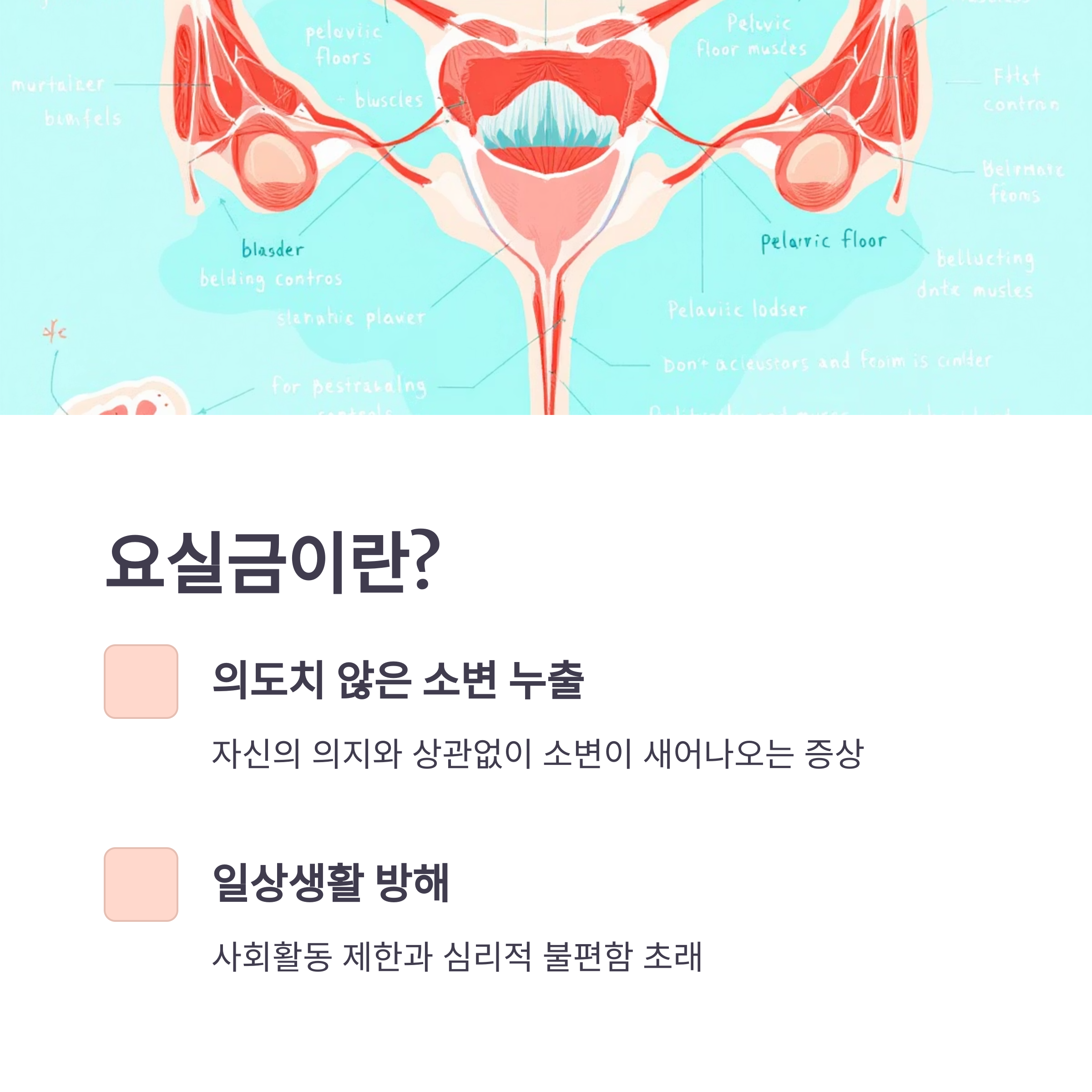 요실금 원인부터 치료까지, 내 몸을 위한 완벽 가이드