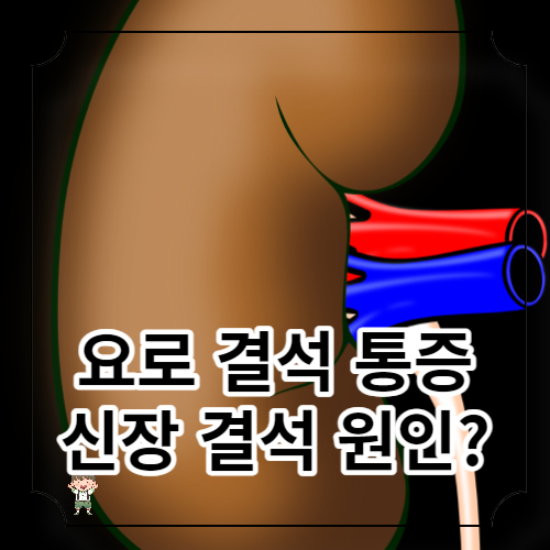 요로결석 증상
