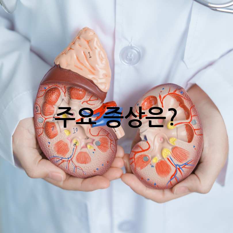 다낭성 신장증후군 증상과 치료법