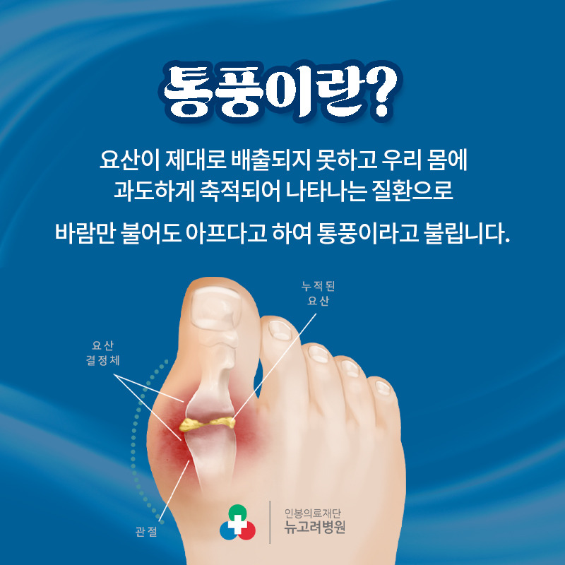 통풍 설명 배너