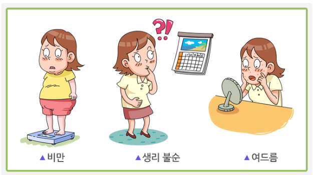 다난성난소증후군 증상