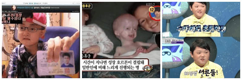 하이랜더-증후군-사례-사진-3개