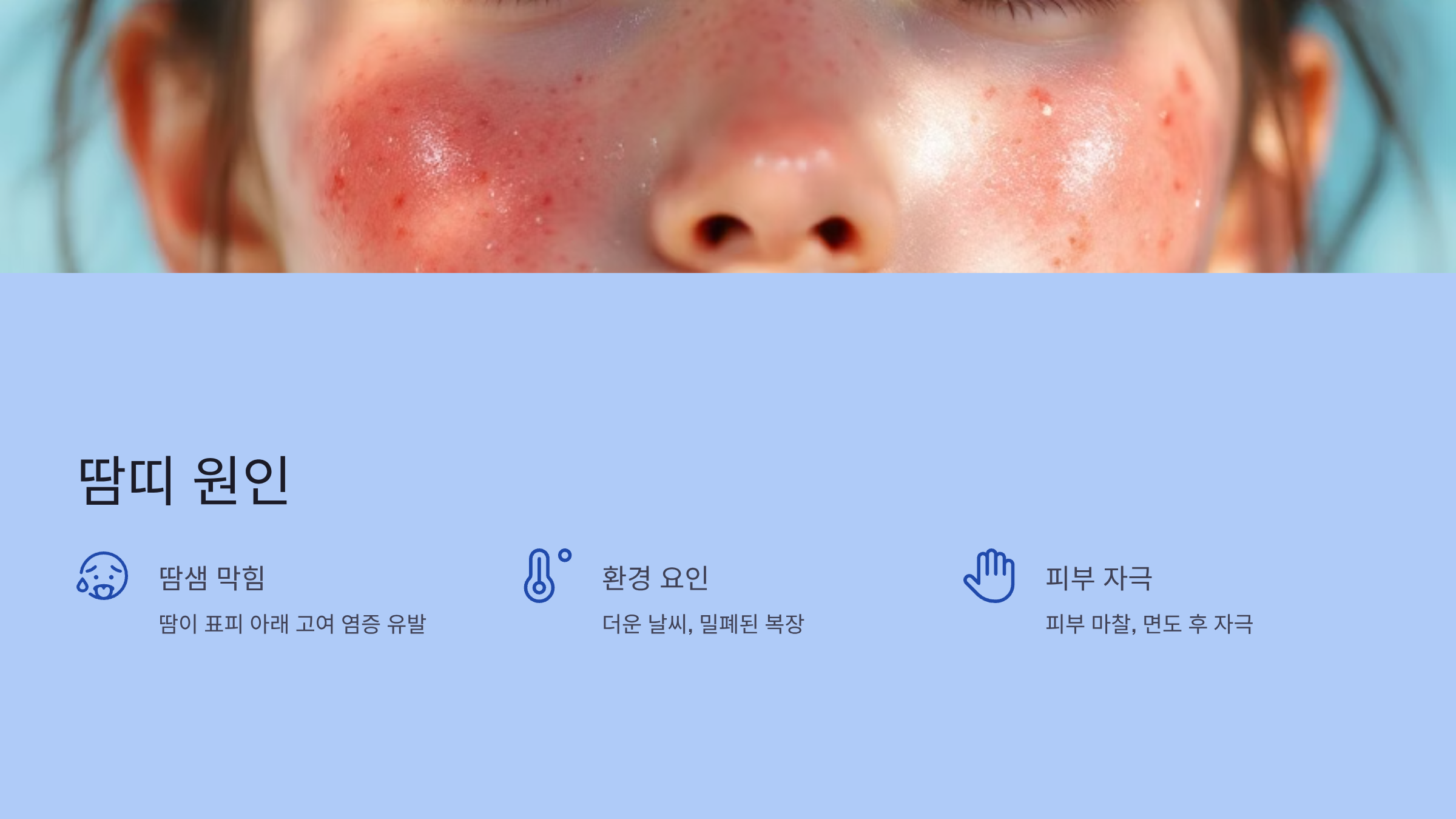 땀띠 원인