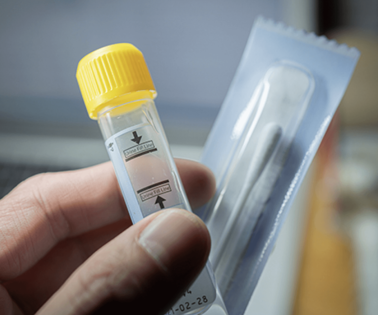 남자-성병-검사