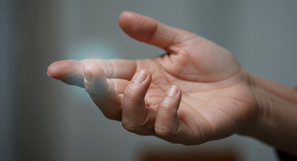 손목터널증후군 증상 사진 11