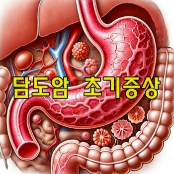 담도암 초기증상