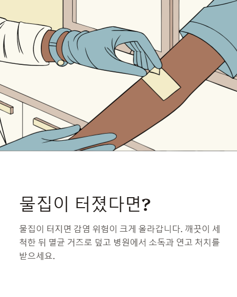 물집이 터졌다면?