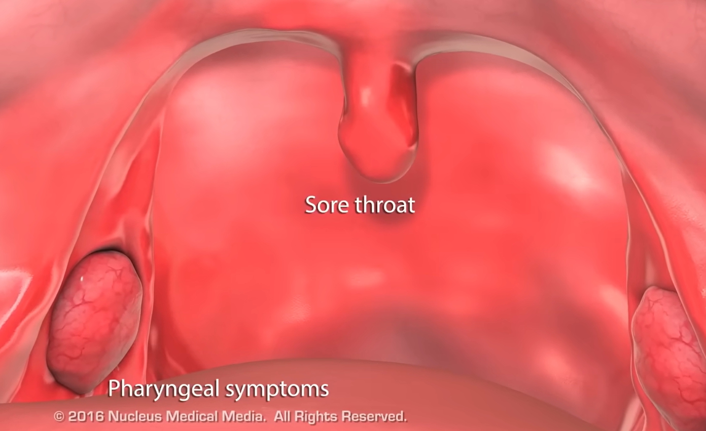 콧물이 계속 나는 이유