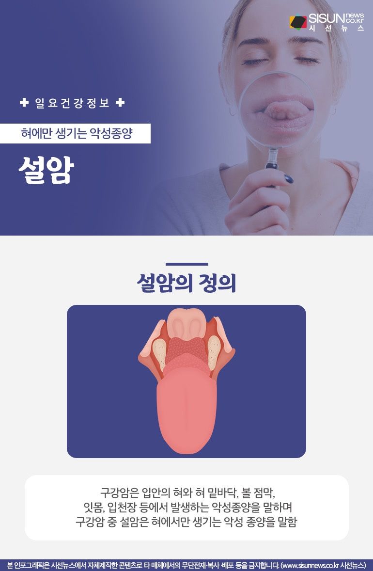 구강암