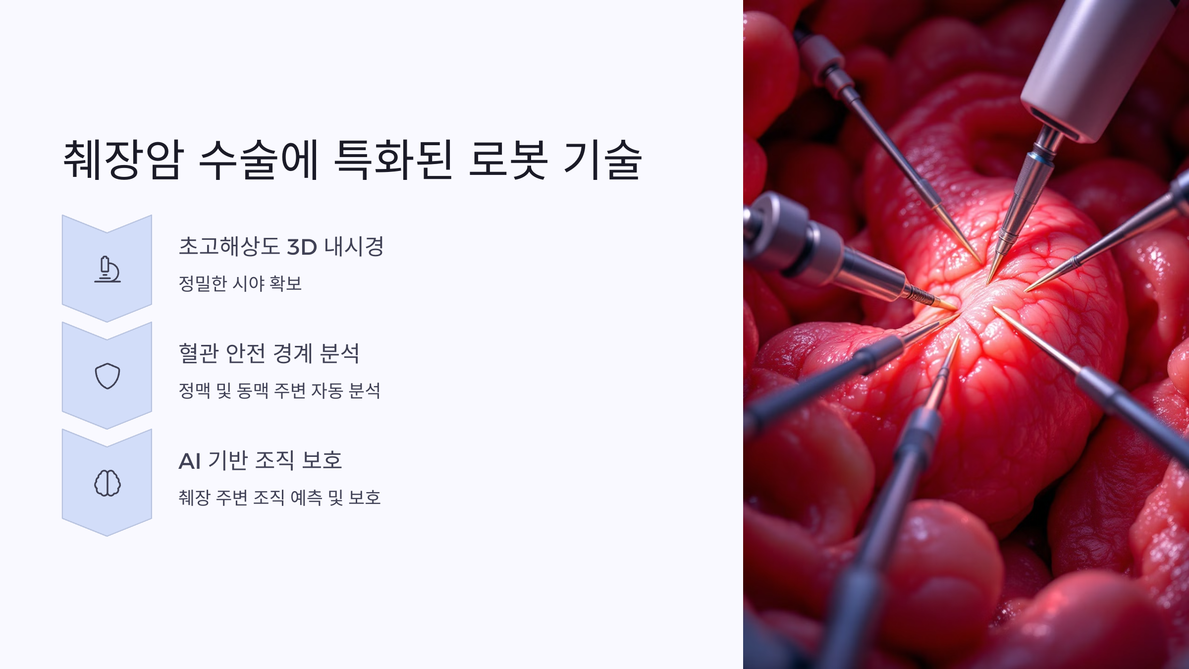 췌장암 수술에 특화된 로봇 기술