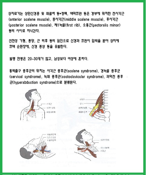 흉곽출구증후군