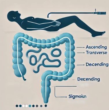 대장내시경 관련 이미지