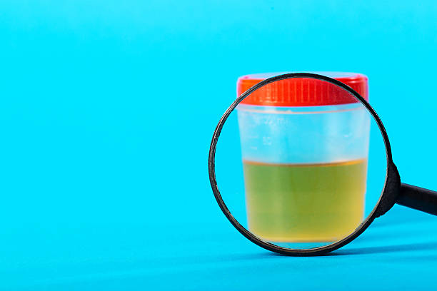 반복되는 요로 감염