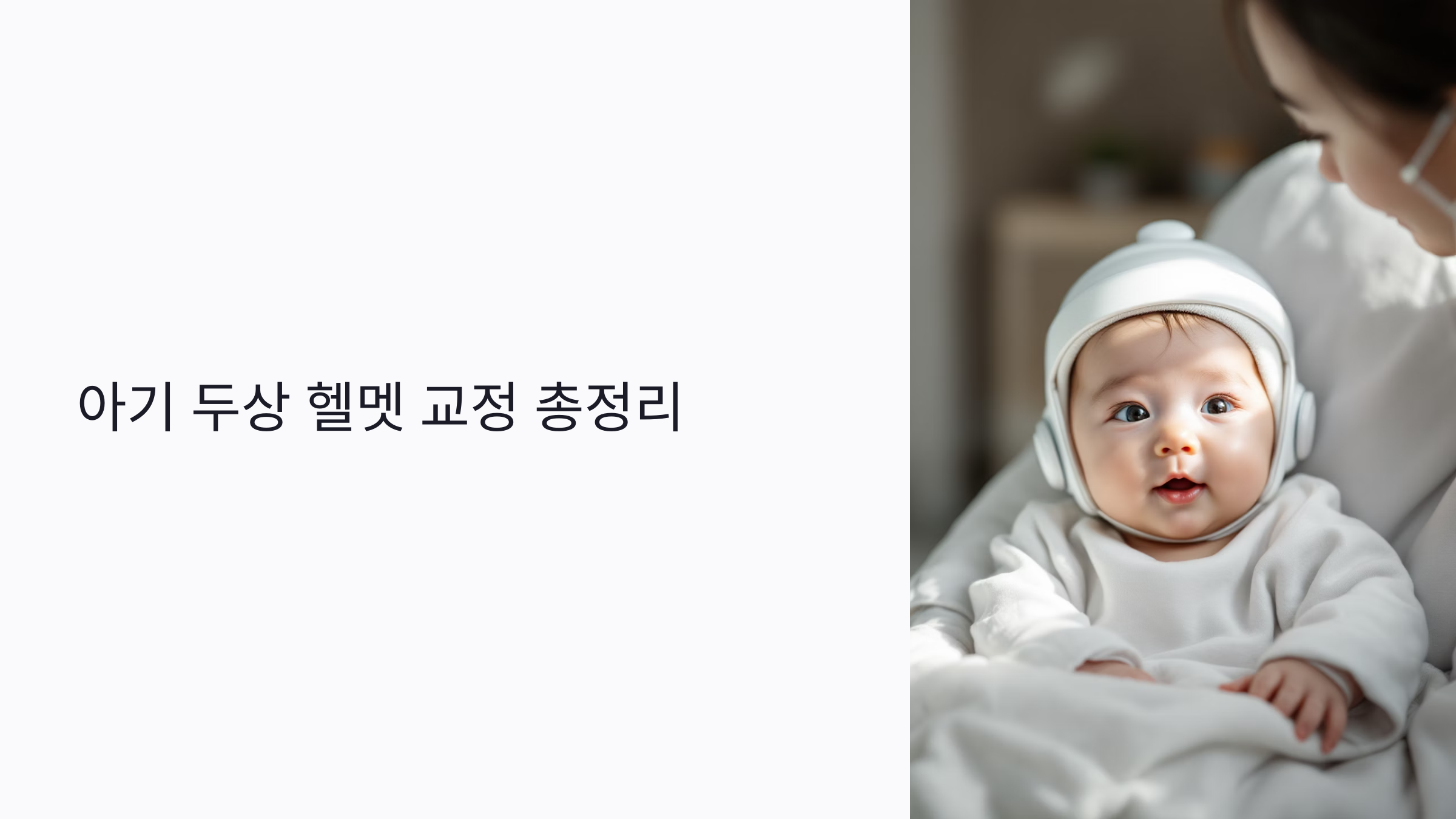 두상 헬멧 교정 언제 시작해야 할까? 아기 머리 변형 해결법 총정리