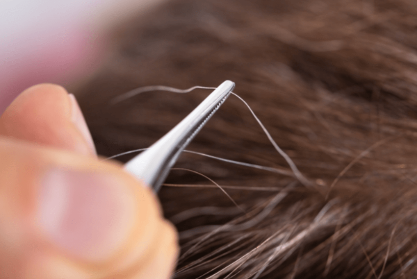 휜머리가 나는 이유