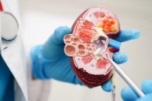 콩팥이안좋으면