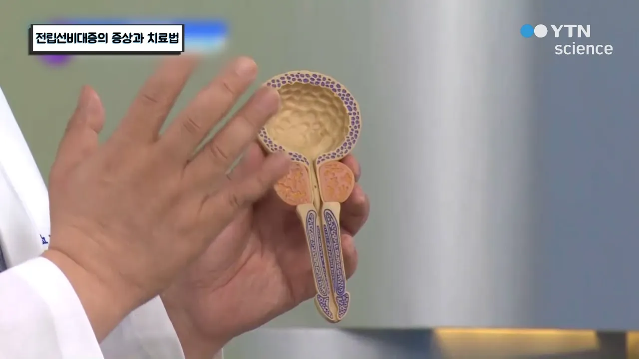 전립선비대증 치료