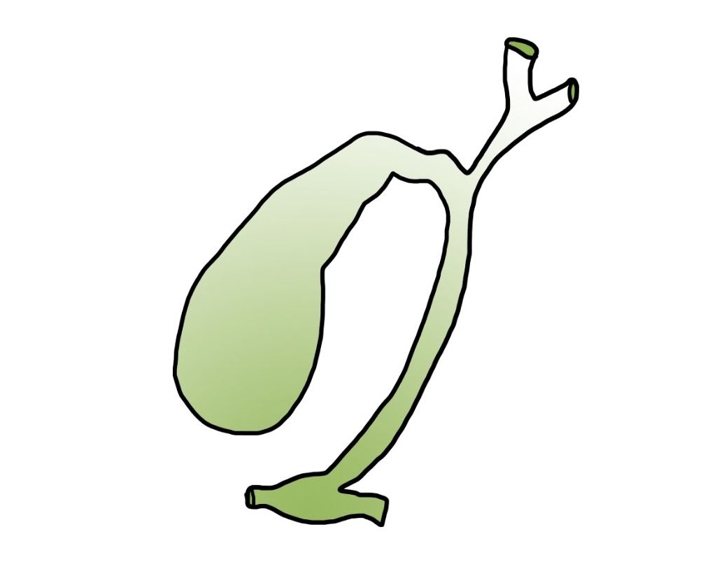 담낭 이미지