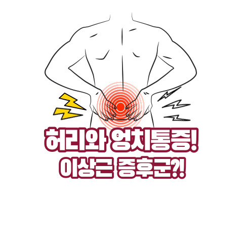 이상근 증후군과 허리통증 원인 살펴보기