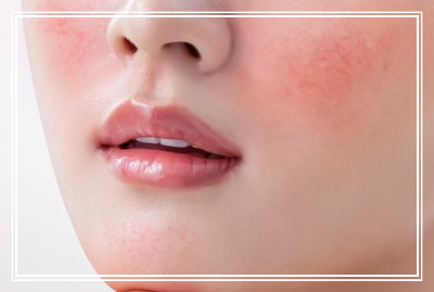 안면이 붉은 모습