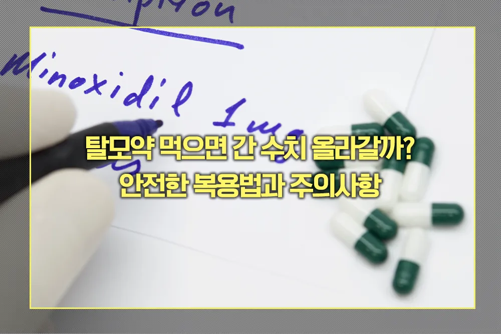 탈모약 간수치 상승 관계