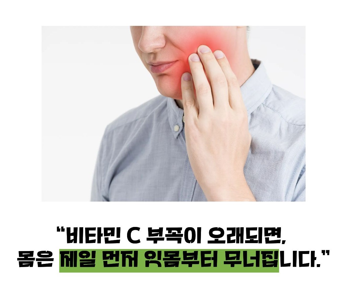 괴혈병 증세, 증상
