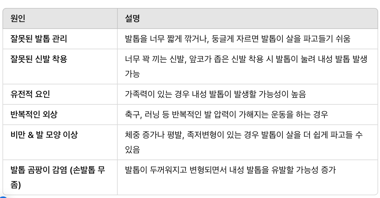 내성 발톱의 주요 원인