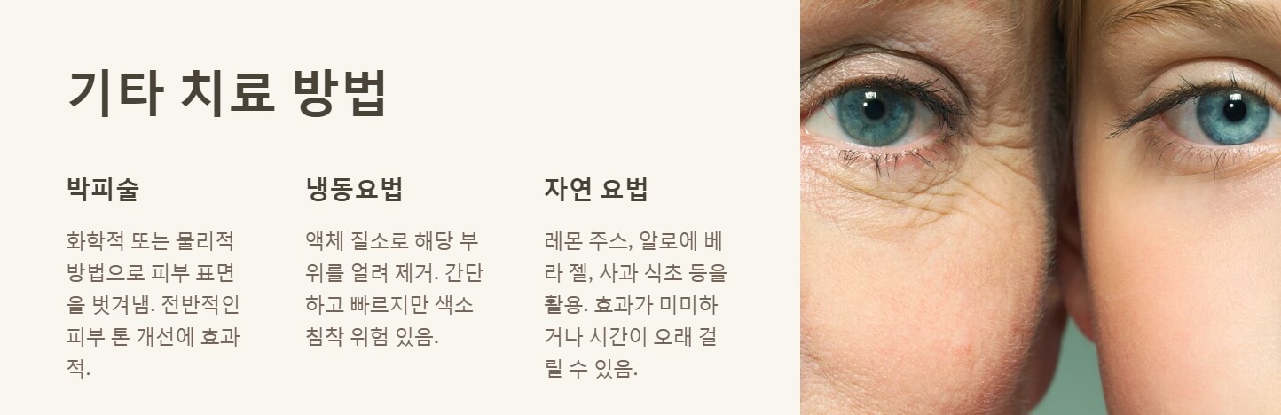 검버섯 없애는 방법
