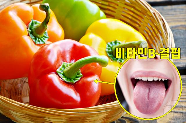 혓바늘 치료 빨리 낫는 법,구내염에 좋은 음식 파프리카