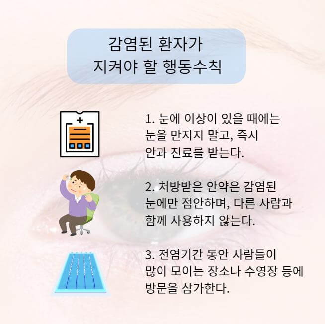 여름 유행 눈병- 유행성 결막염