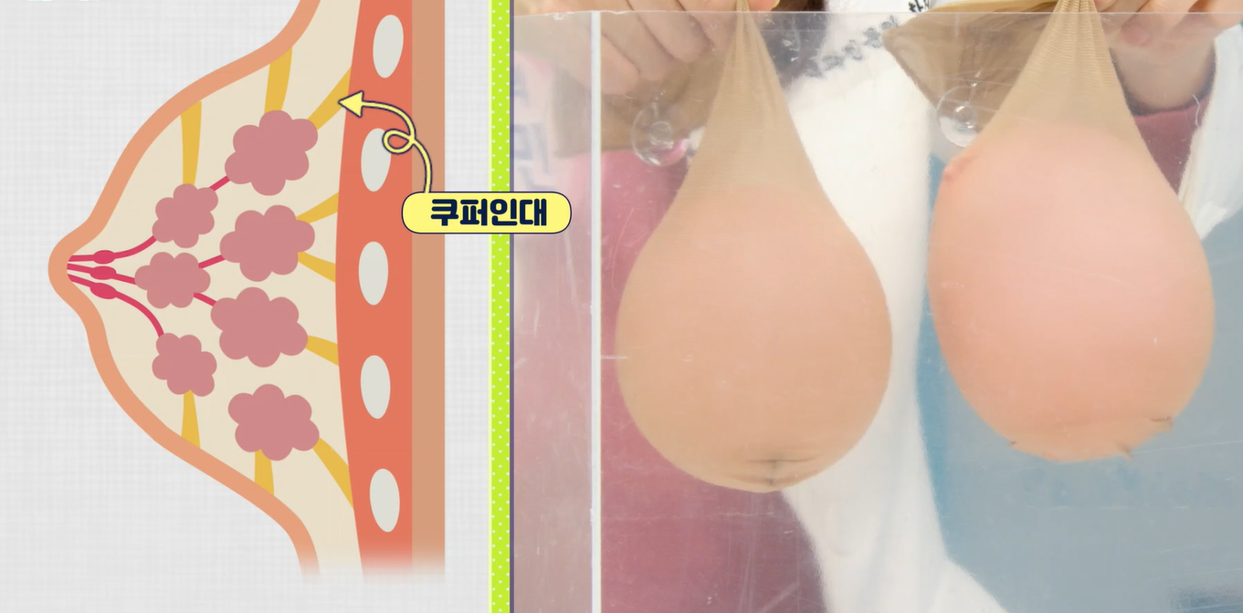 엘라스틴 효능